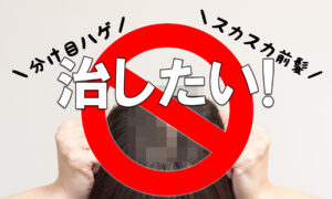 分け目はげを治したい!女性の薄毛種類・対策・改善方法・注意点など