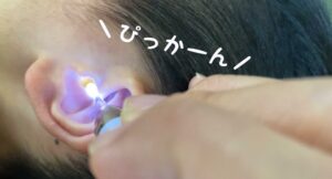 見えるから取れる！光る耳かきとピンセットで子供の耳掃除！使用感レビュー