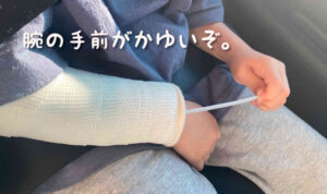 体験談・ギプスがかゆい時の対処法を伝授!100均の結束バンドで解決!